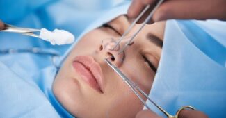 conseils de chirurgie esthetique